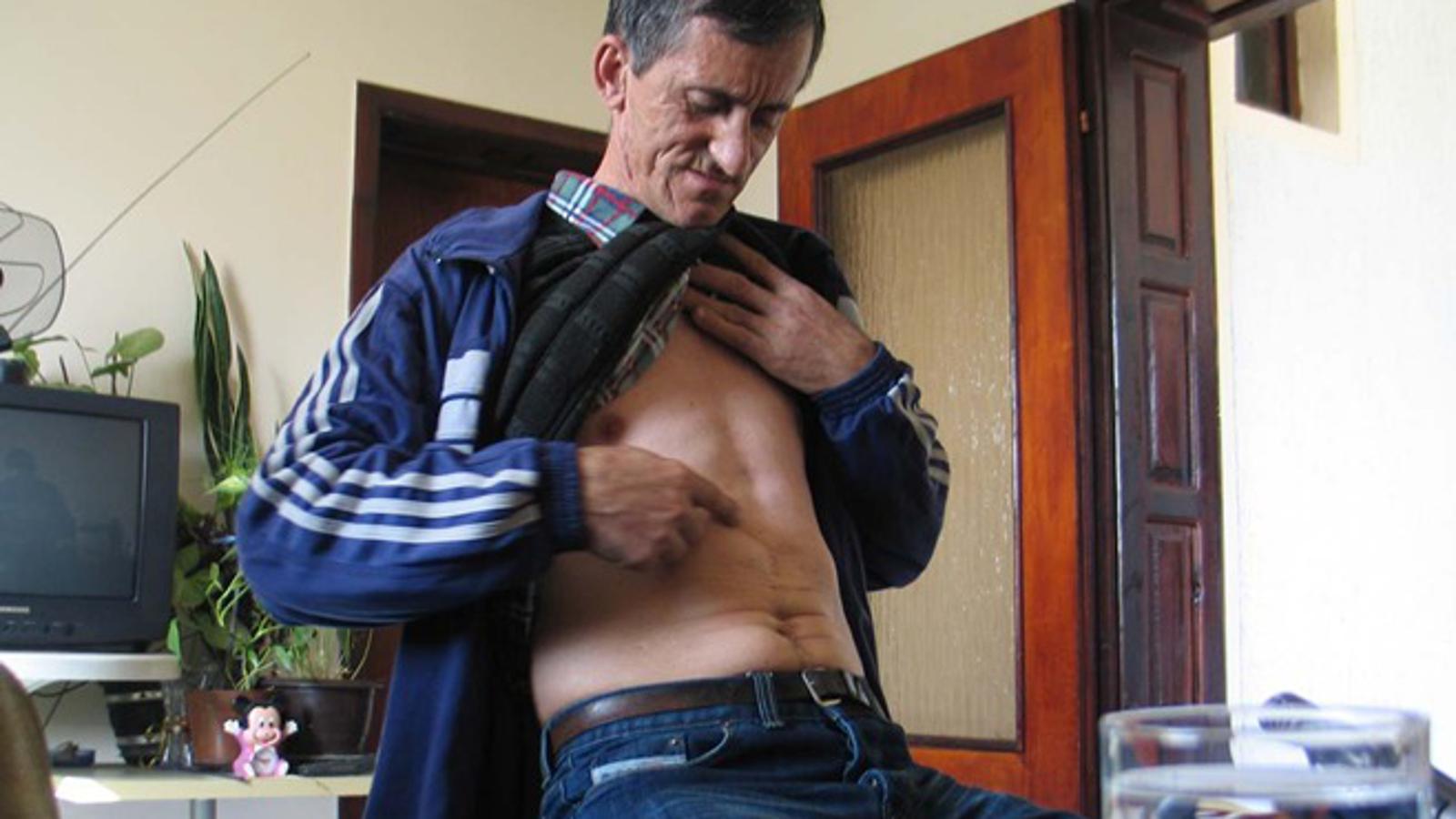 Dimitrije Škrpan, pokazuje gdje je zario komad stakla u stomak